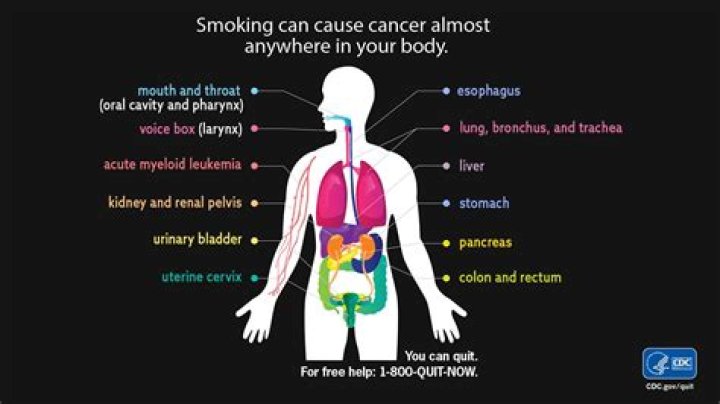 
Does Peter Bosustow Have Cancer? Health Problems Explained 