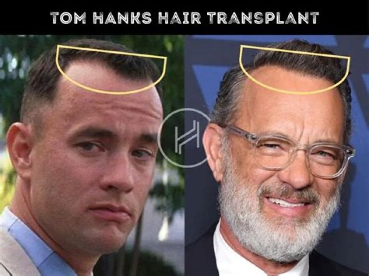 Does Will Arnett Wear A Wig? Murderville Actor Rumored To Have Had An Hair Transplant Or Hair Plug- Details To Know